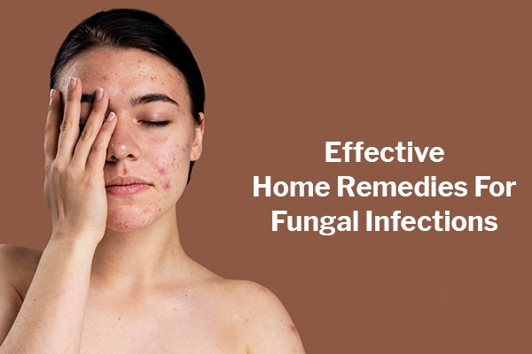 Home Remedies For Fungal Infection